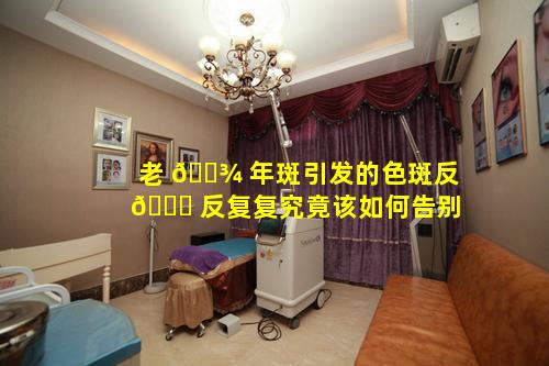 老 🌾 年斑引发的色斑反 🐝 反复复究竟该如何告别